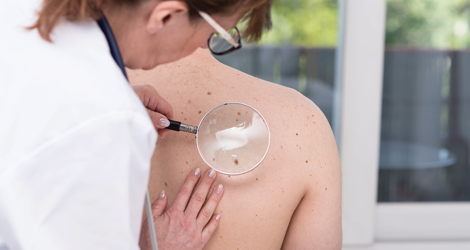 Imagem ilustrativa onde uma médica exame a pele de uma pessoa